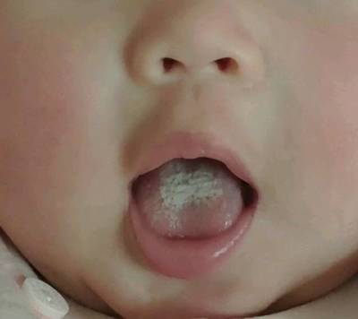 宝宝5个月突然夜醒频繁