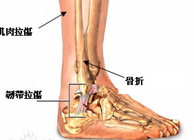 我的脚背疼是怎么回事