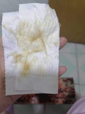 白带会怀孕吗