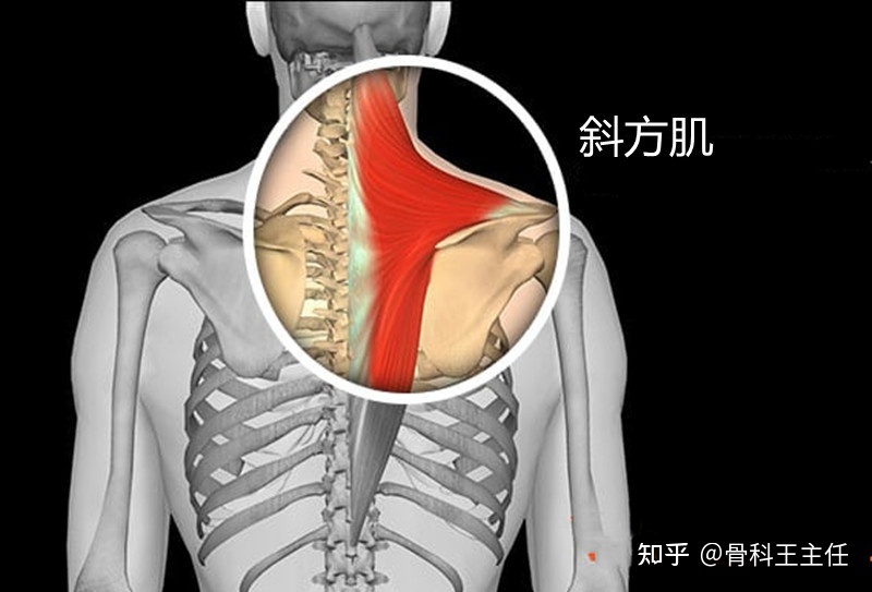 后背胀是怎么回事