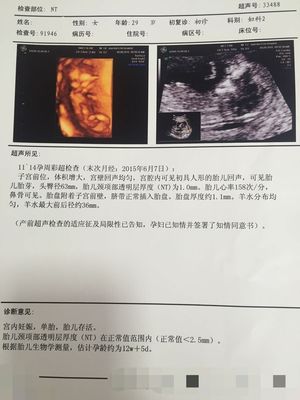怀孕2个月发烧了怎么办