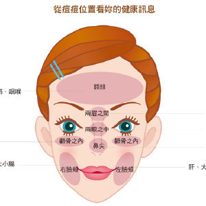 鼻尖起痘痘怎么解决方法