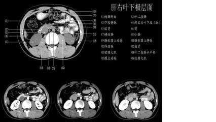 怎么看ct