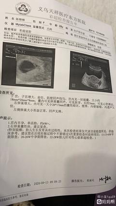 白带褐色是怀孕吗