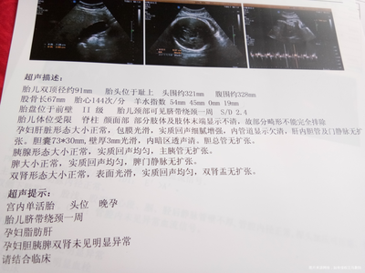 怀孕36周孩子一般几斤