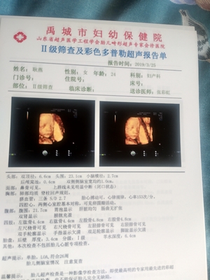 侧脑室宽说明胎儿聪明