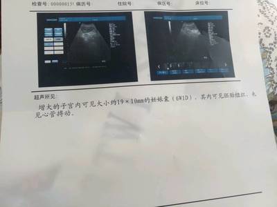 怀孕多久有心管搏动