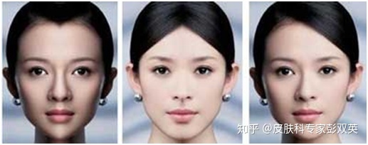 脸型不正左右脸不对称