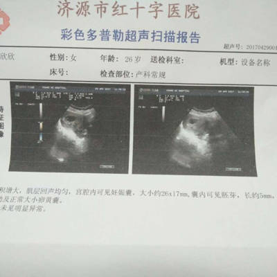 3月怀孕预产期是几月