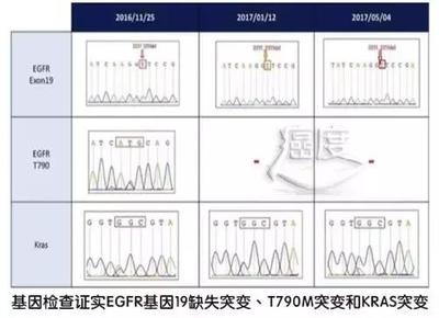 烤瓷牙破了个洞能补吗