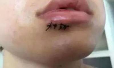 玻璃杯裂了怎么修复
