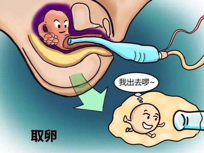 取她人卵多少钱