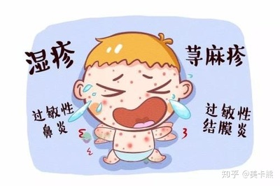 母乳宝宝海鲜过敏症状