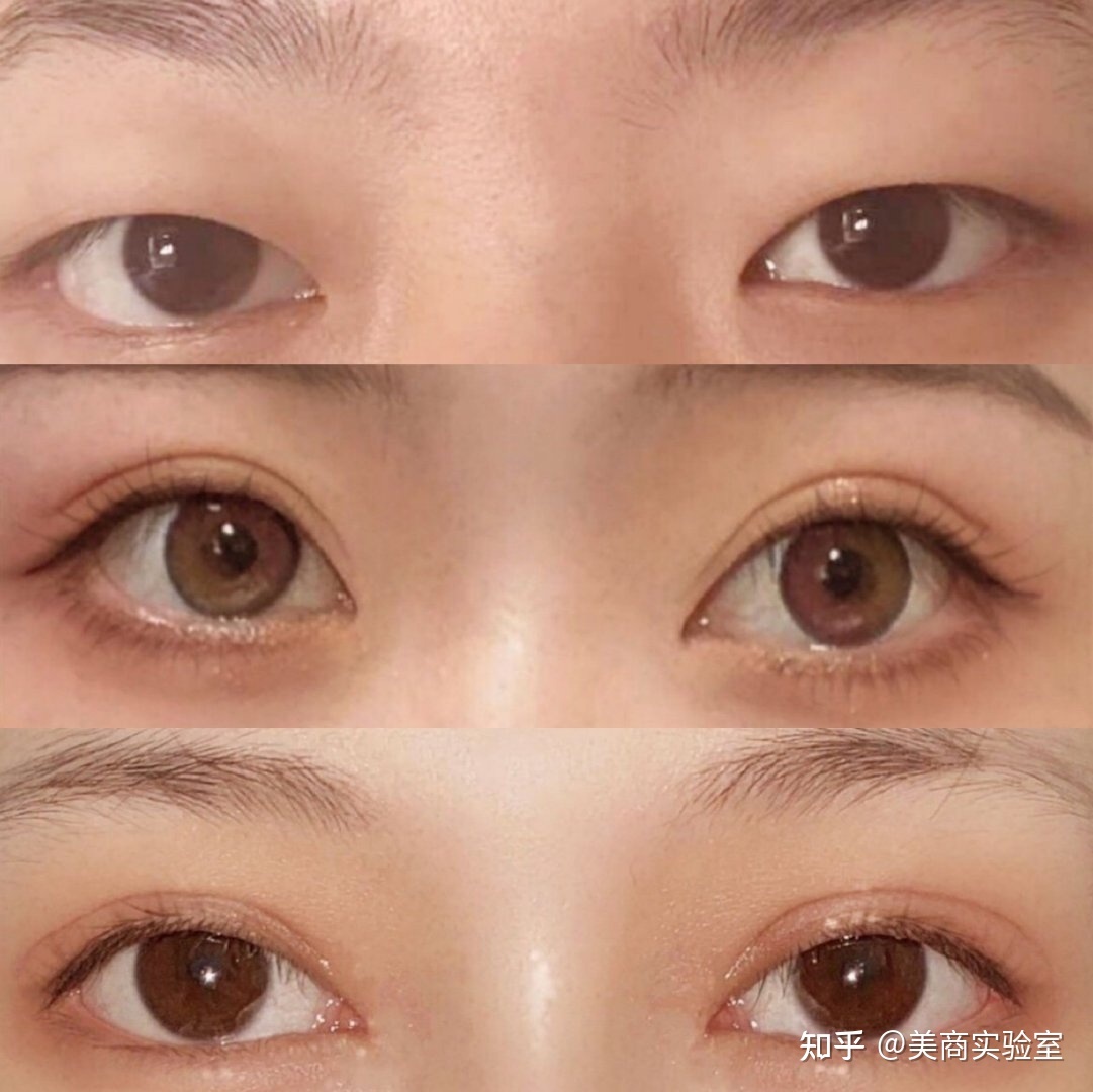 好看的内眦双眼皮