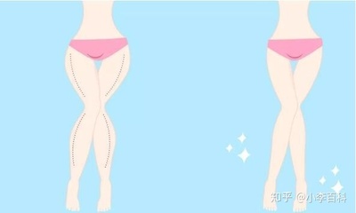 吸脂瘦腿的方法