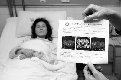 盆骨骨折怎么治疗