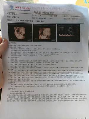 怀孕35天怀男孩症状