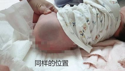 梦到两个孕妇
