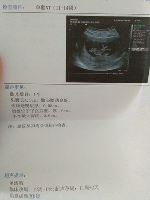 胎儿14周会有胎动吗
