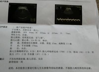 怀孕39周还没入盆正常吗