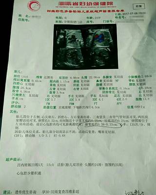 胎儿心包腔少量积液