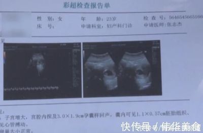 全麻之后多久可以怀孕