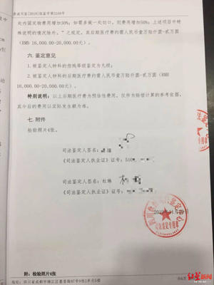 肋骨骨折司法鉴定标准