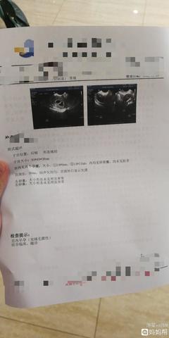孕吐越厉害胎儿越稳定