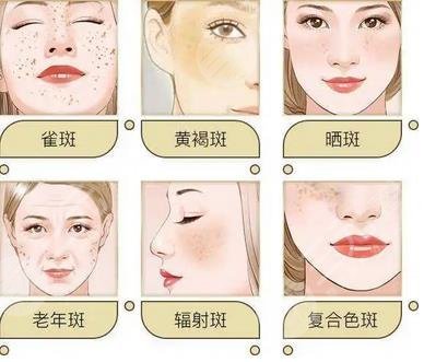 面部毛孔粗大用什么护肤品