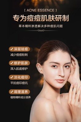 痘痘肌的四个成因