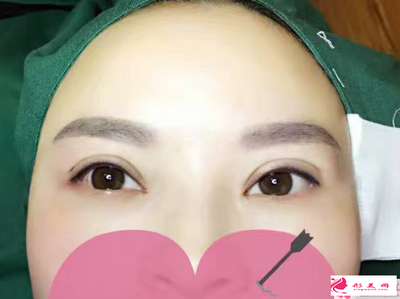 割双眼皮好看吗