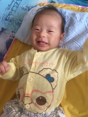 二个月宝宝贫血怎么办
