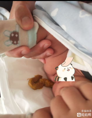 一个月宝宝不拉大便怎么办