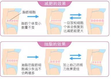 抽脂融脂
