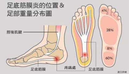 足底疼是怎么回事