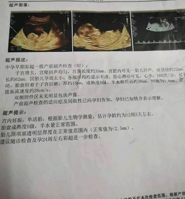 经常梦见自己生孩子
