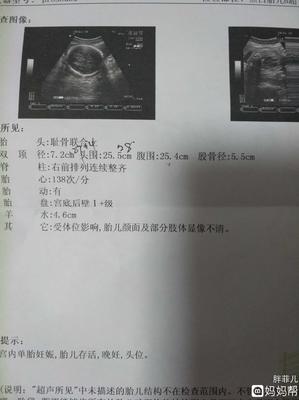 28周婴儿双顶径是多少