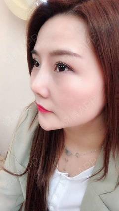 去哪里隆鼻好