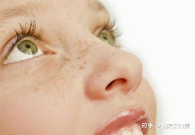 遗传斑怎么治疗