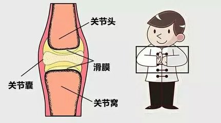膝盖关节响是怎么回事