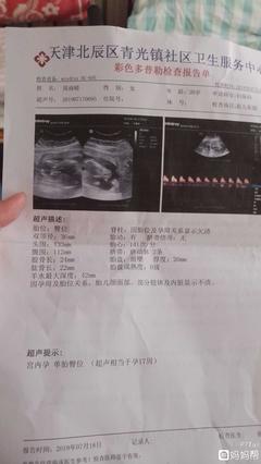 十七周胎儿