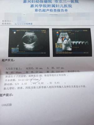 怀孕39周还没入盆正常吗