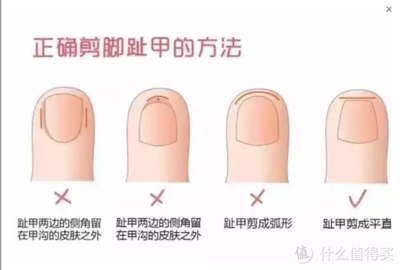 一个月的宝宝可以剪指甲吗