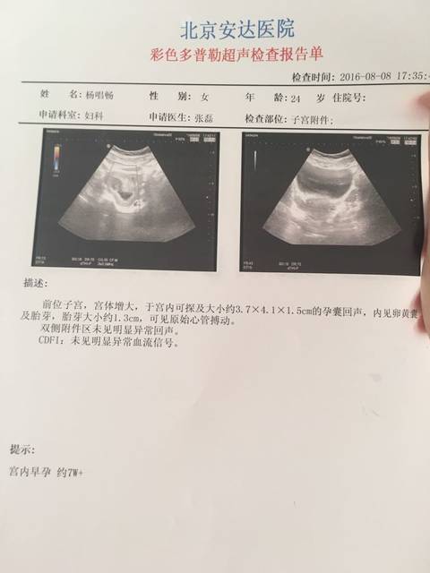 怀孕50天有胎心吗