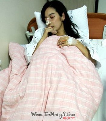 怀孕梦到流产了