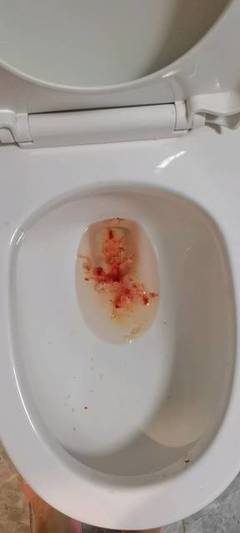 怀孕了吐血怎么回事