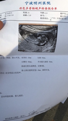 怀孕多少周可以做nt