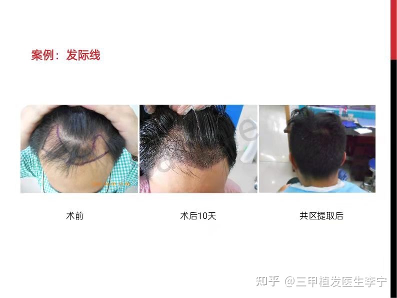 烫发大概要多少钱