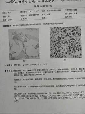 坐月子可以吃长豆吗