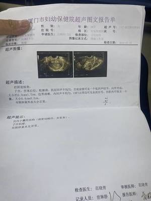 全麻之后多久可以怀孕